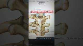 Thoracic vertebrae Atlas netter anatomy [upl. by Verne501]