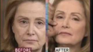 Facelift Surgery Featured on Fox  Facial Plastic Surgeon [upl. by Kerianne]