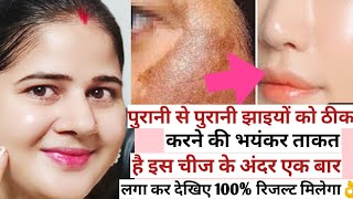 Skin repair  hyper pigmentation remove in 15 days remove dark spots anti agingfaceglow [upl. by Agnese]