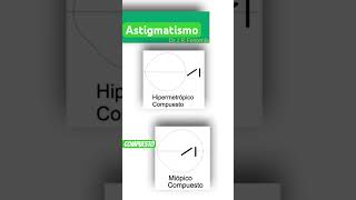 Astigmatismo Compuesto [upl. by Mountford]