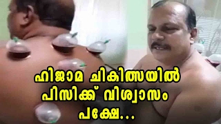 Hijama Treatment And Controversy  Oneindia Malayalam [upl. by Karylin916]