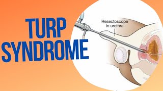 TransUrethral Resection Syndrome TURP SYNDROME [upl. by Corneille]