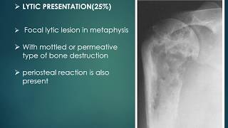 chondroblastoma case presentation with differential diagnosis [upl. by Norry]