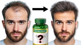 The ONLY Hair Loss Supplements You Need See Results in 30 Days [upl. by Shanks]