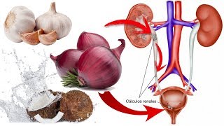 tus riñones están llorando por ayuda corre y has este remedios caserosalvarlos ellos son tu vida [upl. by Kinch721]