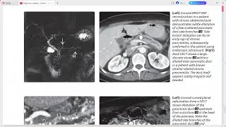 PANCREAS DIAGNOSTIC IMAGING SERIES [upl. by Ylevol177]