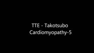 Takotsubo Cardiomyopathy  Transthoracic Echocardiogram TTE [upl. by Dilaw]