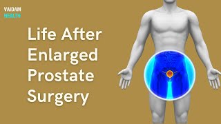 Life After Enlarged Prostate Surgery [upl. by Aeneg301]