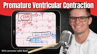 Premature Ventricular Contractions PVC EKG  ECG Lecture [upl. by Anitsenre]