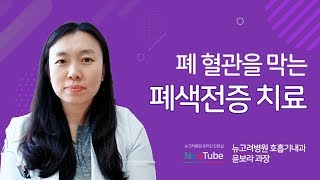 폐색전증 치료 폐색전증을 주의해야 하는 사람 [upl. by Anne-Marie709]