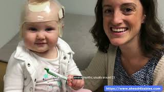 Newborn Misshapen Head Positional Plagiocephaly Treatment [upl. by Entirb]