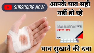 घाव सुखाने की दवाCiprofloxacin 500mg use ciprofloxacin hydrochloride helthptipsciplox [upl. by Augie712]