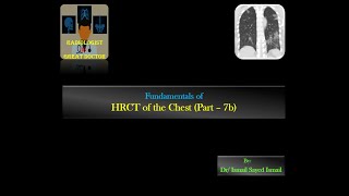 HRCT chest for Radiology Residents  Part 7b  Mosaic Pattern [upl. by Thelma508]