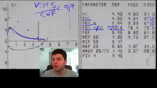 Spirometrie 4  exemplu DVO disfunctie ventilatorie obstructiva [upl. by Janet]