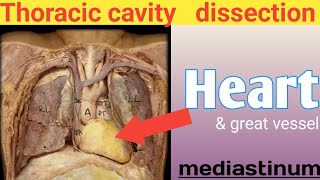 Heart dissection ❤ real human body Mediastinum thoracic cavity anatomy internal organs [upl. by Eedrahs296]