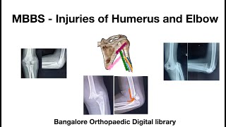 MBBS  Humerus and Elbow injuries [upl. by Eiramnaej]