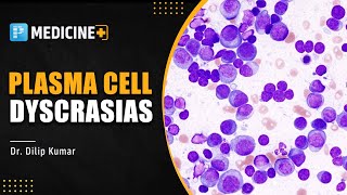 Plasma Cell Dyscrasias by Dr Dilip kumar  PrepLadder  NEET SS [upl. by Georgetta]