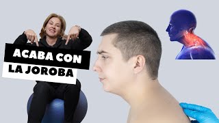 ACABA CON LA JOROBA [upl. by Celka]