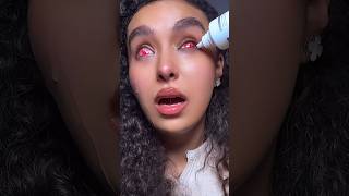 Part 2 😱 trying to remove sclera lenses 🧟‍♀️ nouhailaait [upl. by Roshan]