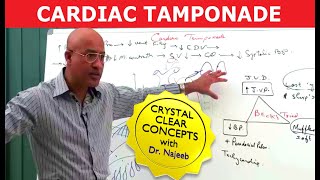 Cardiac Tamponade  Causes Symptoms and Treatment🫀 [upl. by Noskcaj]