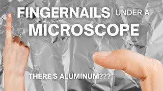 How Do Fingernails Look under a Microscope [upl. by Anailil655]