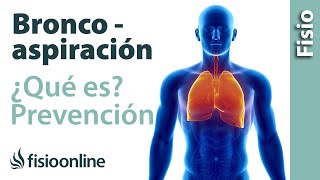 Qué es la broncoaspiración cómo evitarla y tratamiento desde la fisioterapia respiratoria [upl. by Nairdad]