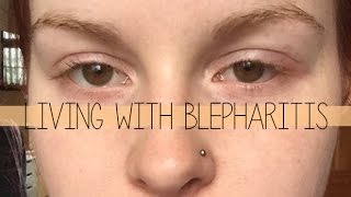 Living with Blepharitis [upl. by Zetrom]