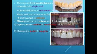 Introduction of Prosthodontics مقدمة عن الاستعاضة الصناعية [upl. by Zola]