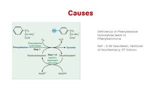 Phenylketonuria PKU  Phenylalanine Metabolism [upl. by Balling]