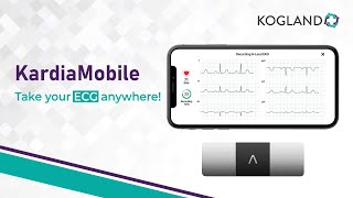 Kardia Mobile  Easy amp Reliable ECG Monitoring Anytime Anywhere [upl. by Bergen]