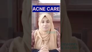 മുഖക്കുരു മാറാൻ ഇങ്ങനെ ചെയ്താൽ മതി  Pimples Home remedies Malayalam pimples acne [upl. by Esinahs]