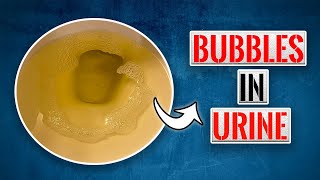 Bubbles in Urine After Peeing What You Should doo [upl. by Harvard]