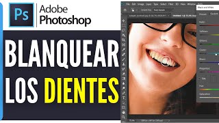 Como Blanquear Los Dientes En Photoshop 2024 [upl. by Ahsyad219]