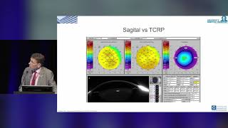 Pentacam® AXL – Clinical Results [upl. by Einreb]