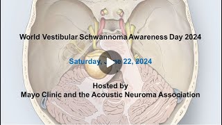 Vestibular schwannoma Molecularlyinformed therapies [upl. by Yrannav]