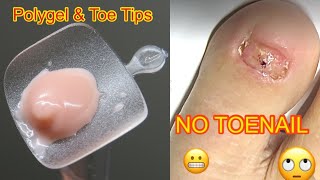 Polygel amp Toe Tips  Get a Toenail Easy [upl. by Seely979]