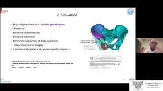 Les nouveaux eldorados du CAOS  traumatologie [upl. by Kristien]