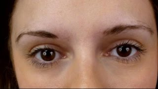 Women Turn to Eyebrow Transplants for Fuller Brows [upl. by Morgen938]