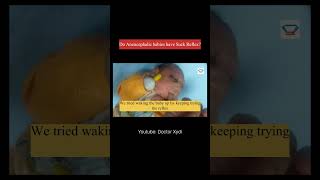 Suck Reflex in Anencephalic Babies [upl. by Yahsan]