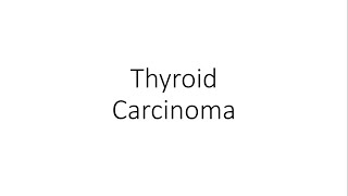 Thyroid Carcinoma  For Medical Students [upl. by Moody]