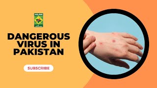 Monkey pox Virus Symptoms  Dangerous Virus In Pakistan  Lively Weekend  MasalaTV [upl. by Aneer779]