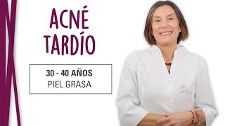 ACNÉ TARDÍO en la piel 3040 años  ¿Por qué salen granos a edad adulta TRATAMIENTO [upl. by Fortunia]