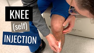 Knee Injection Steroid Technique Blind Anterolateral Approach [upl. by Ruelle527]