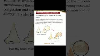 Rhinitis  typesetiologyrisk factor management complications symptoms diagnosis shorts viral [upl. by Rhyne]