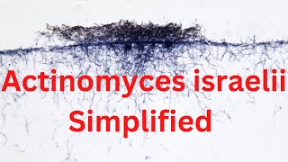 Actinomyces israelii Simplified TRICK [upl. by Yona]