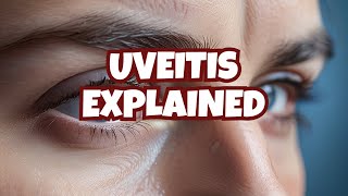 Anterior uveitis posterior uveitis and panuveitis etiology symptoms diagnosis and treatment [upl. by Daney]