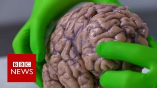 Up close with a human brain  BBC News [upl. by Weaks114]