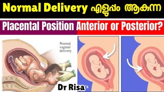 പ്രസവം എളുപ്പമാകുന്ന Placental Position  Anterior amp Posterior Placenta [upl. by Yaker405]