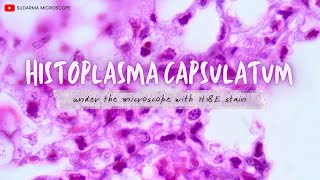 Histoplasma capsulatum under the microscope with Haematoxylin and Eosin HampE stain [upl. by Lirret]