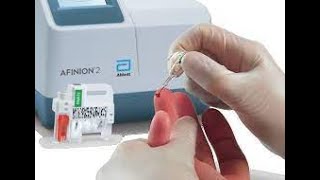 Afinion™ 2 Analyzer  Introduction  Tutorial [upl. by Ethelbert406]